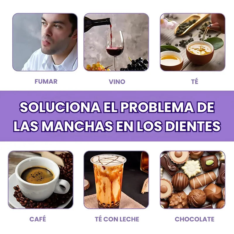 SMILE KIT® | Blanqueador Dental V34