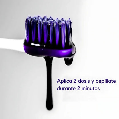 SMILE KIT® | Blanqueador Dental V34