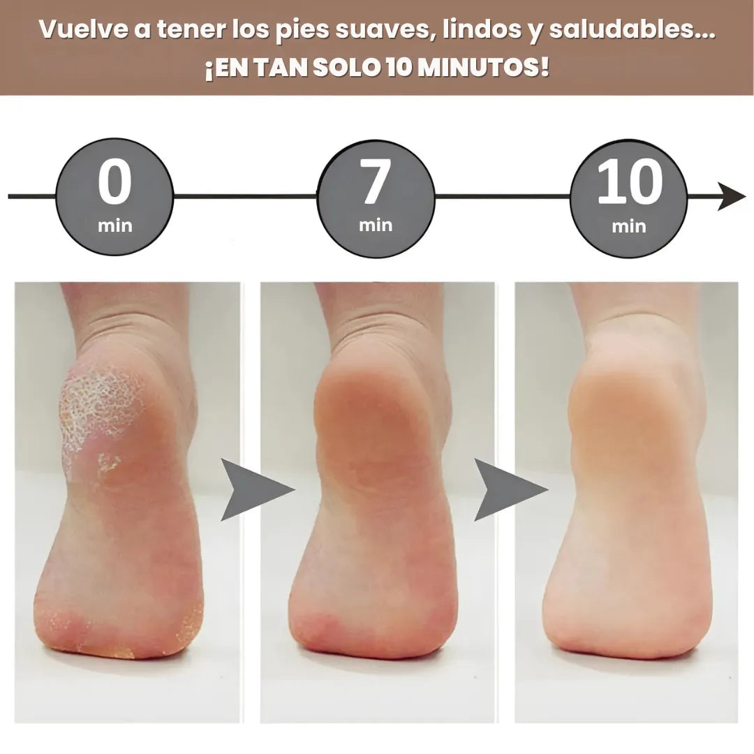 Removedor de Callos Electrico + Regalo | PureFeet®