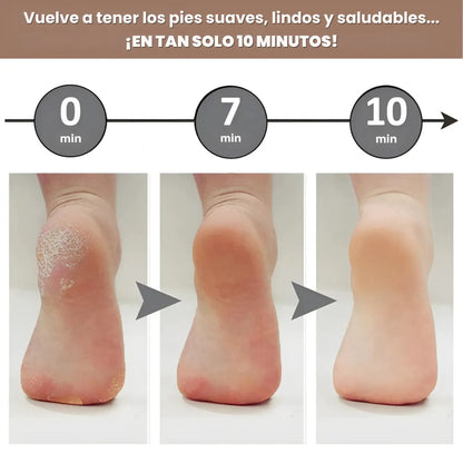 Removedor de Callos Electrico + Regalo | PureFeet®