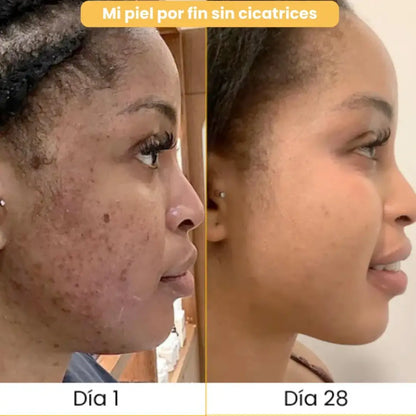 3 Jabones Turmica® | Piel Pareja y Luminosa en 21 Días