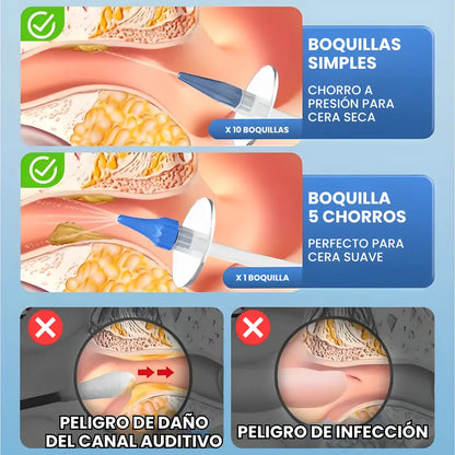 KIT AUDIXCLEAN® - La forma segura de limpiar tus oídos