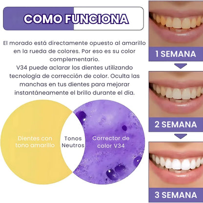 SMILE KIT® | Blanqueador Dental V34