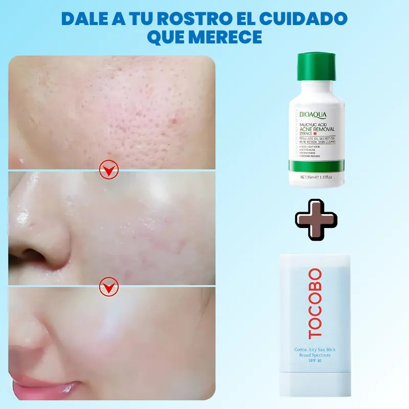 Encabezado