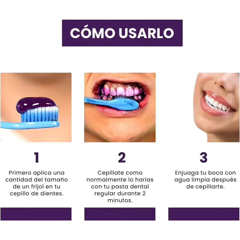 SMILE KIT® | Blanqueador Dental V34