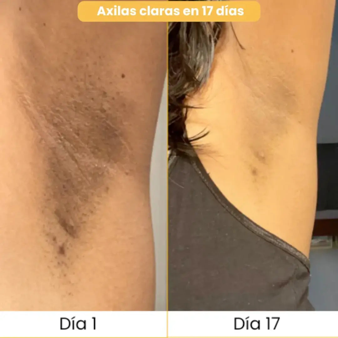 3 Jabones Turmica® | Piel Pareja y Luminosa en 21 Días