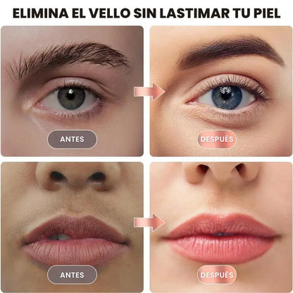 Depilador Facial Flawless® | ¡Libre de vellos al instante!